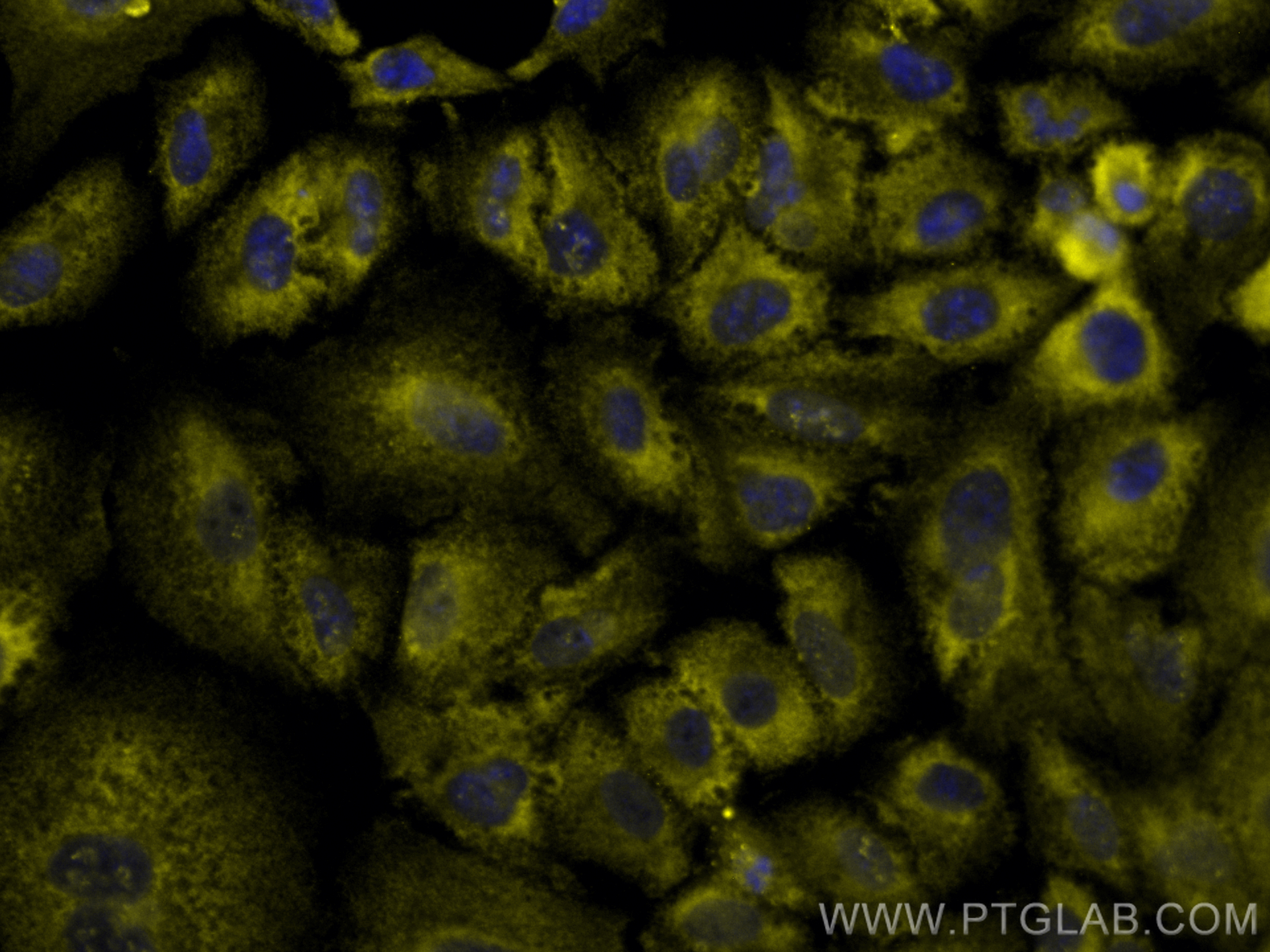 Immunofluorescence (IF) / fluorescent staining of A549 cells using CoraLite®532-conjugated CD47 Monoclonal antibody (CL532-66304)