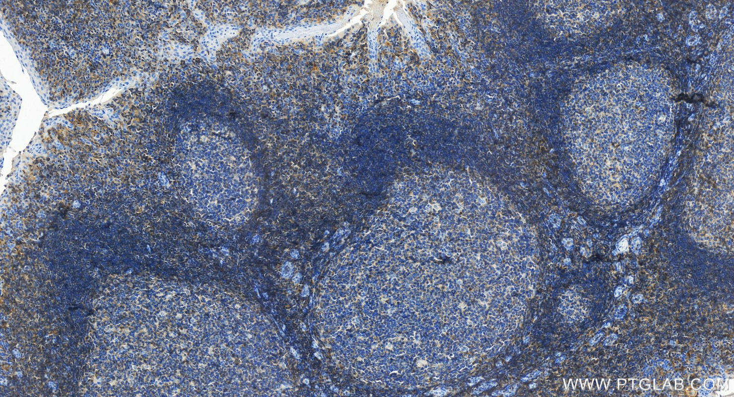 Immunohistochemistry (IHC) staining of human tonsillitis tissue using CD48 Polyclonal antibody (27519-1-AP)