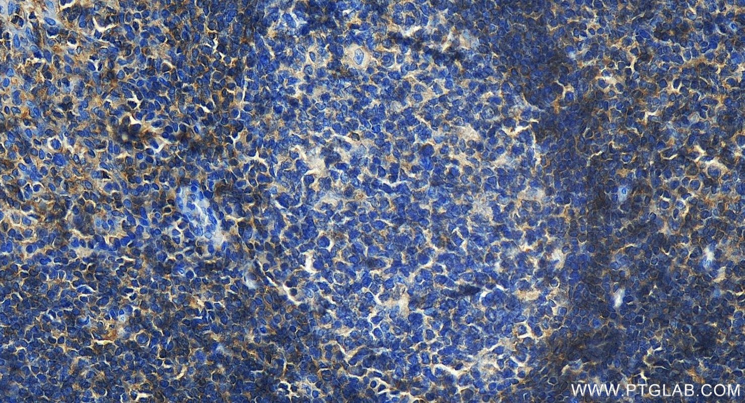 Immunohistochemistry (IHC) staining of human tonsillitis tissue using CD48 Polyclonal antibody (27519-1-AP)