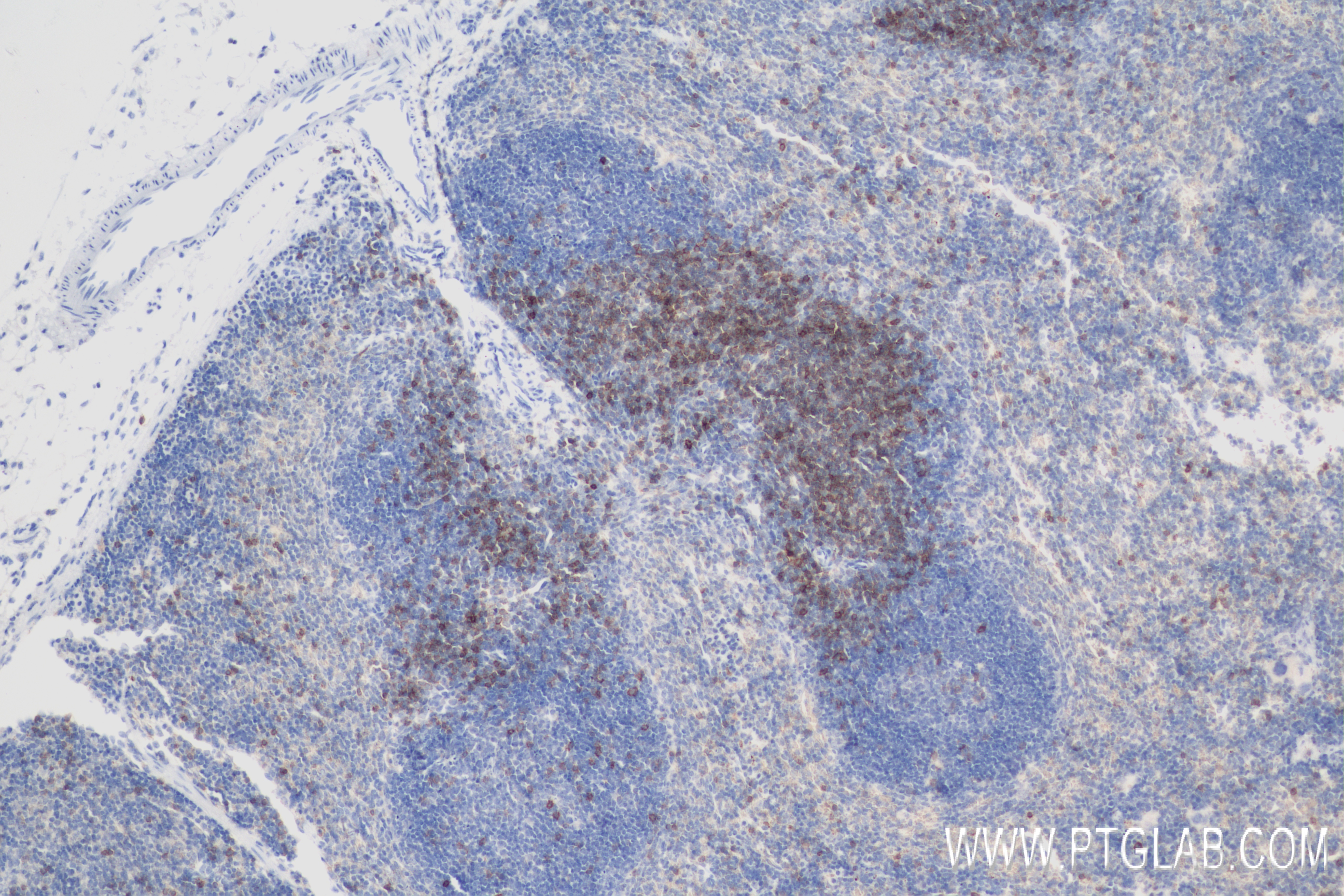 Immunohistochemistry (IHC) staining of mouse spleen tissue using CD5 Recombinant antibody (83451-4-RR)