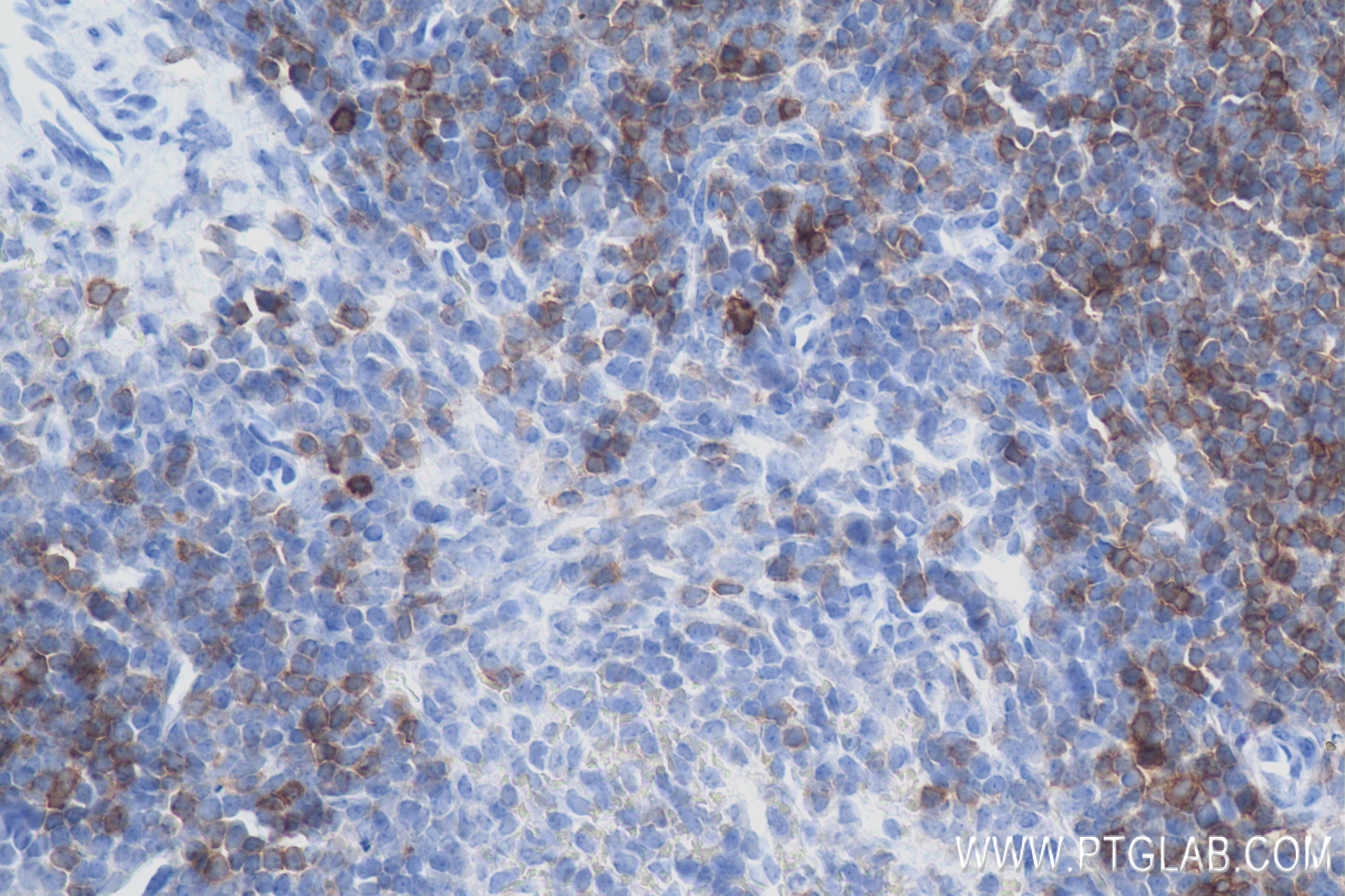 Immunohistochemistry (IHC) staining of mouse spleen tissue using CD5 Recombinant antibody (83451-4-RR)