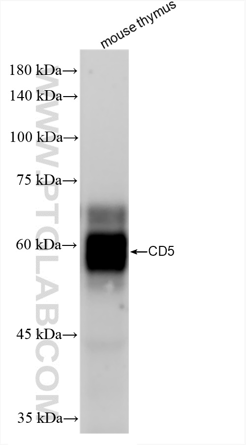 Western Blot (WB) analysis of mouse thymus tissue using CD5 Recombinant antibody (83451-4-RR)