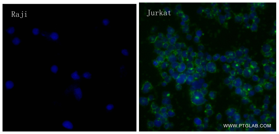 Immunofluorescence (IF) / fluorescent staining of Jurkat cells using CD5 Recombinant antibody (83543-6-RR)