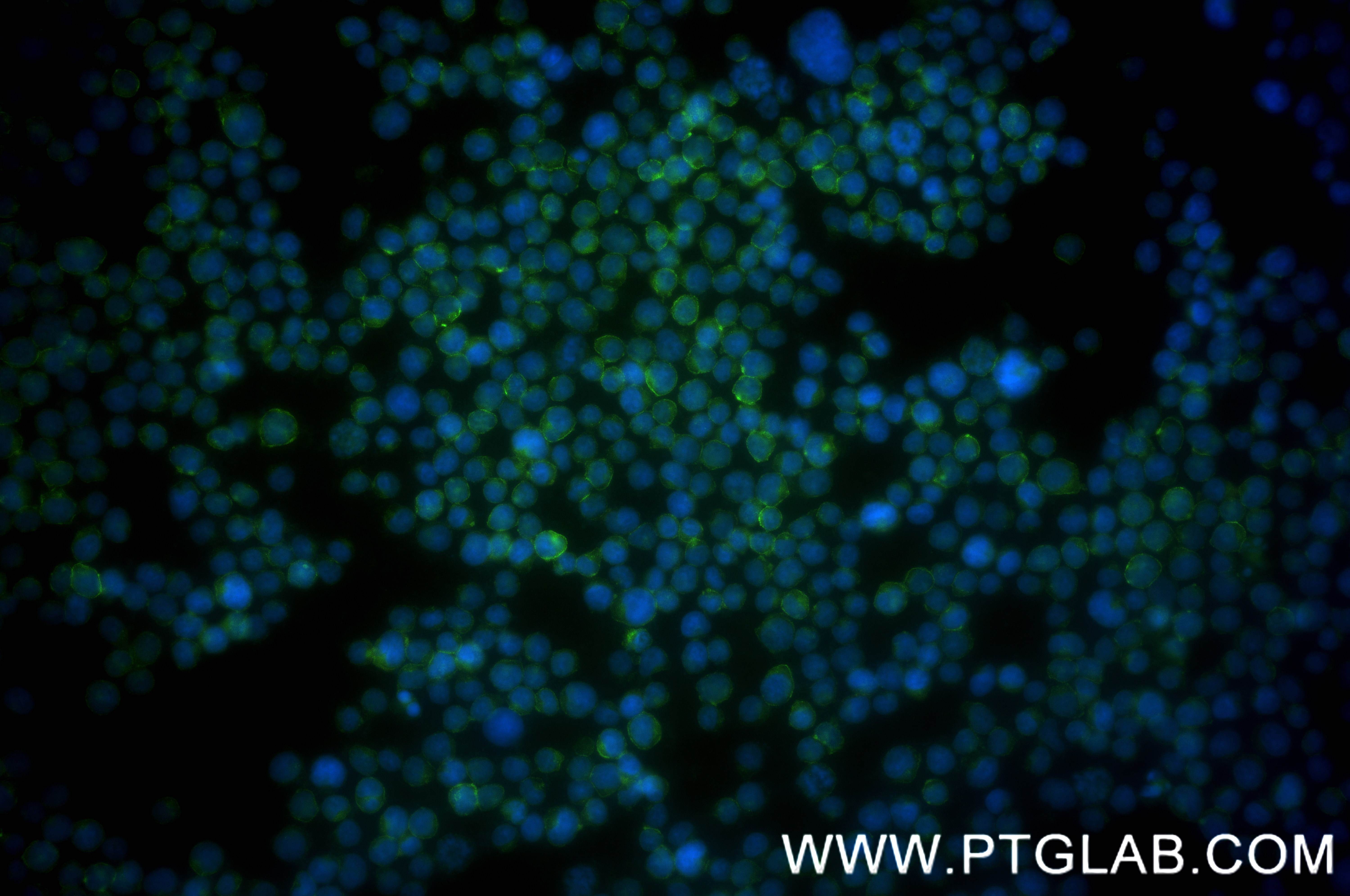 Immunofluorescence (IF) / fluorescent staining of Jurkat cells using CD5 Recombinant antibody (83543-7-RR)