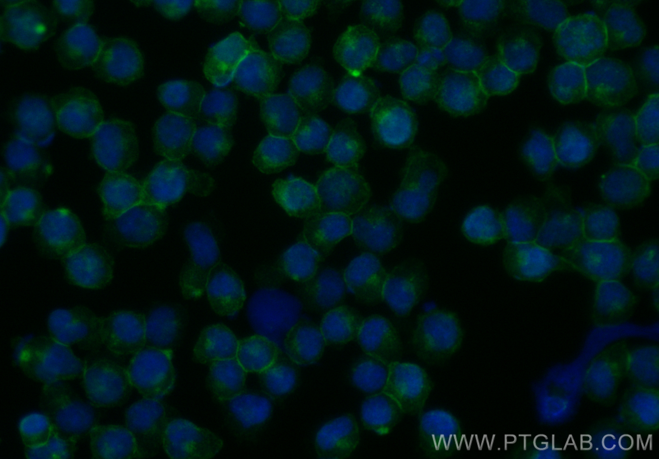 Immunofluorescence (IF) / fluorescent staining of Jurkat cells using CoraLite® Plus 488-conjugated CD5 Recombinant anti (CL488-83543-6)