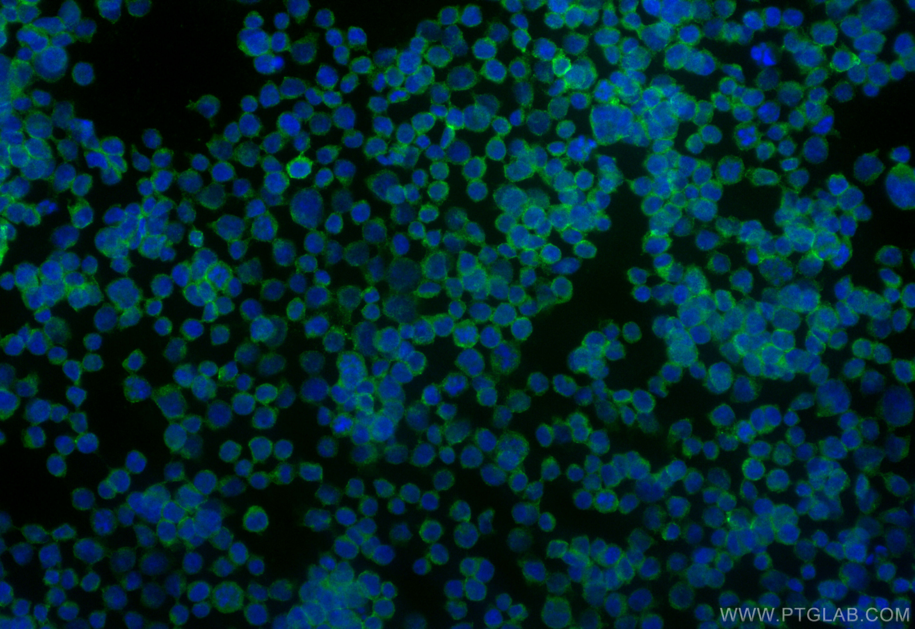 Immunofluorescence (IF) / fluorescent staining of Jurkat cells using CD53 Recombinant antibody (84837-1-RR)