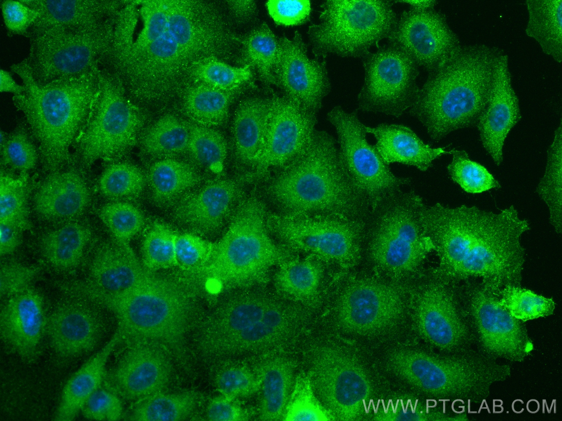 Immunofluorescence (IF) / fluorescent staining of A549 cells using CD55 Recombinant antibody (82781-6-RR)