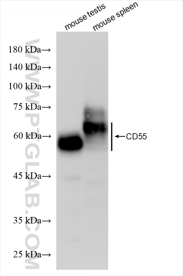 Western Blot (WB) analysis of various lysates using CD55 Recombinant antibody (84519-4-RR)