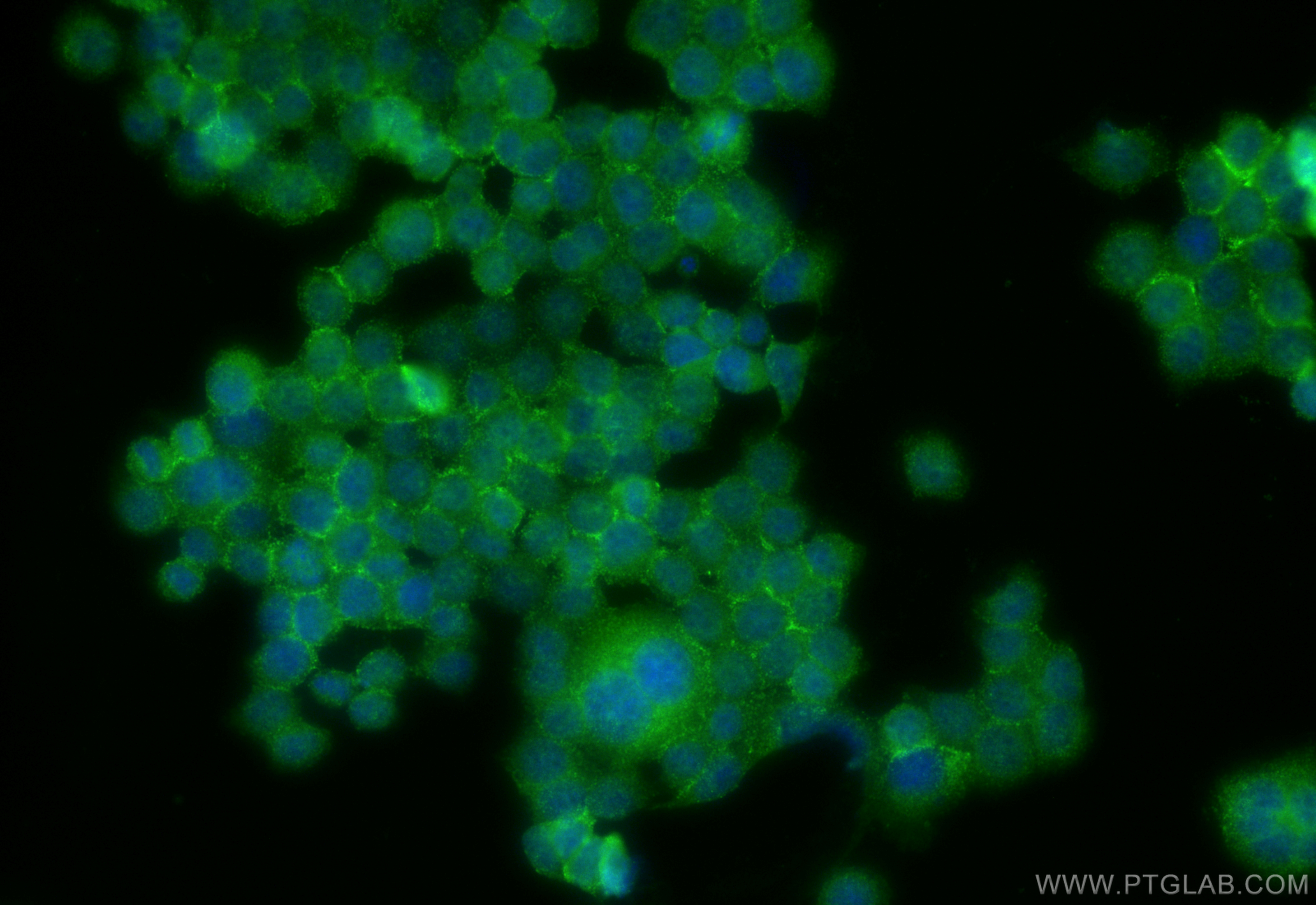 Immunofluorescence (IF) / fluorescent staining of BxPC-3 cells using CD59 Polyclonal antibody (10742-1-AP)