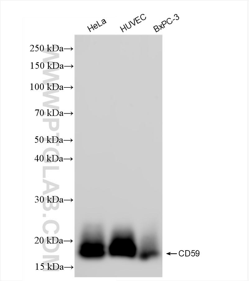 Western Blot (WB) analysis of various lysates using CD59 Recombinant antibody (84447-1-RR)