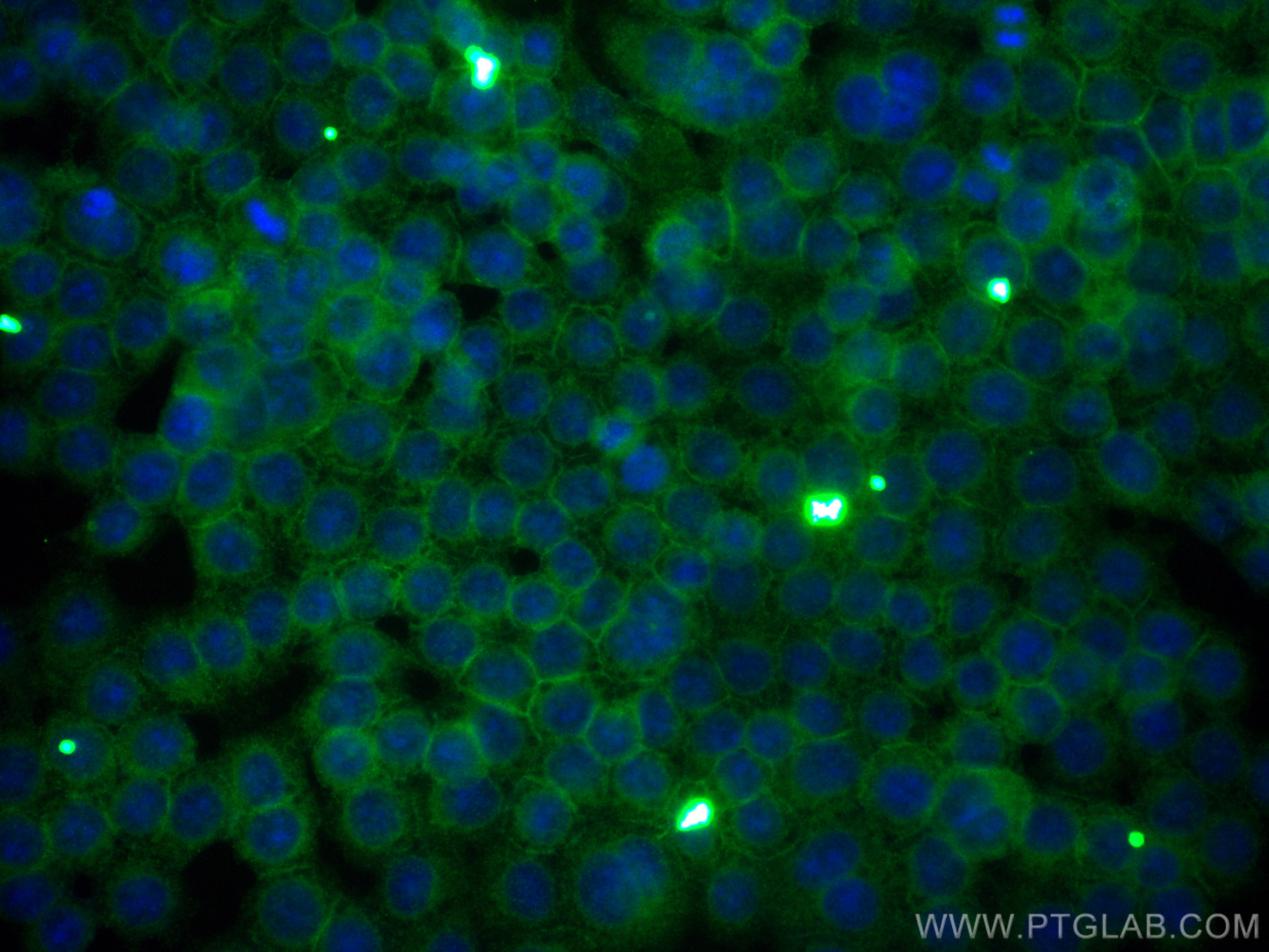 Immunofluorescence (IF) / fluorescent staining of BxPC-3 cells using CoraLite® Plus 488-conjugated CD59 Monoclonal anti (CL488-68222)