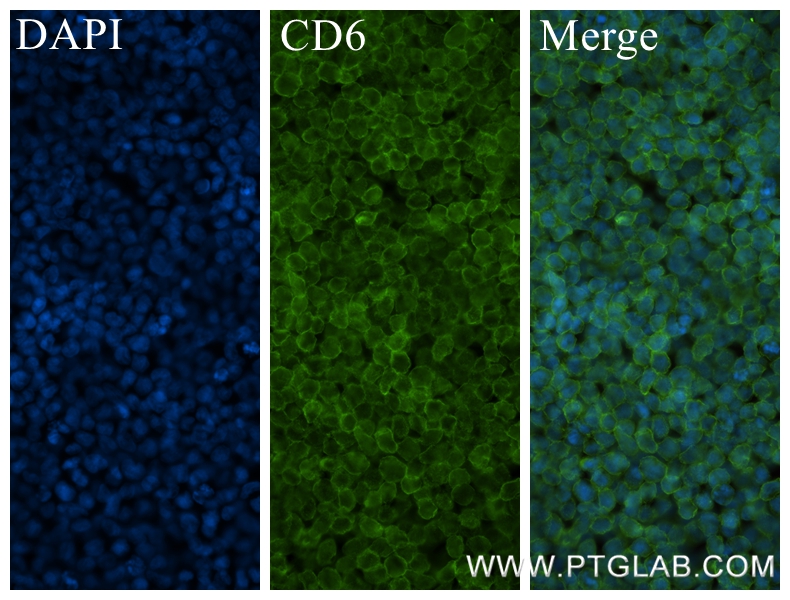 Immunofluorescence (IF) / fluorescent staining of MOLT-4 cells using CD6 Recombinant antibody (84508-4-RR)