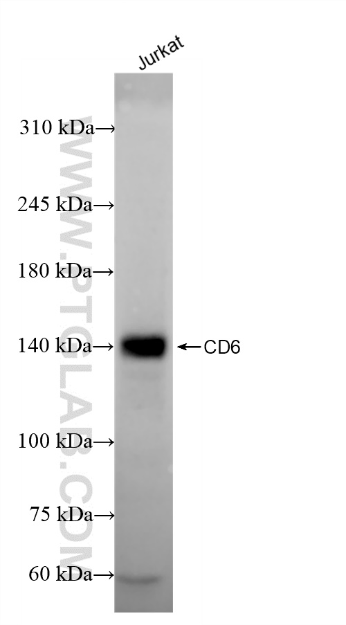 Western Blot (WB) analysis of Jurkat cells using CD6 Recombinant antibody (84508-5-RR)