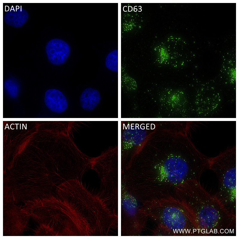 Immunofluorescence (IF) / fluorescent staining of A431 cells using CD63 Recombinant antibody (84507-4-RR)