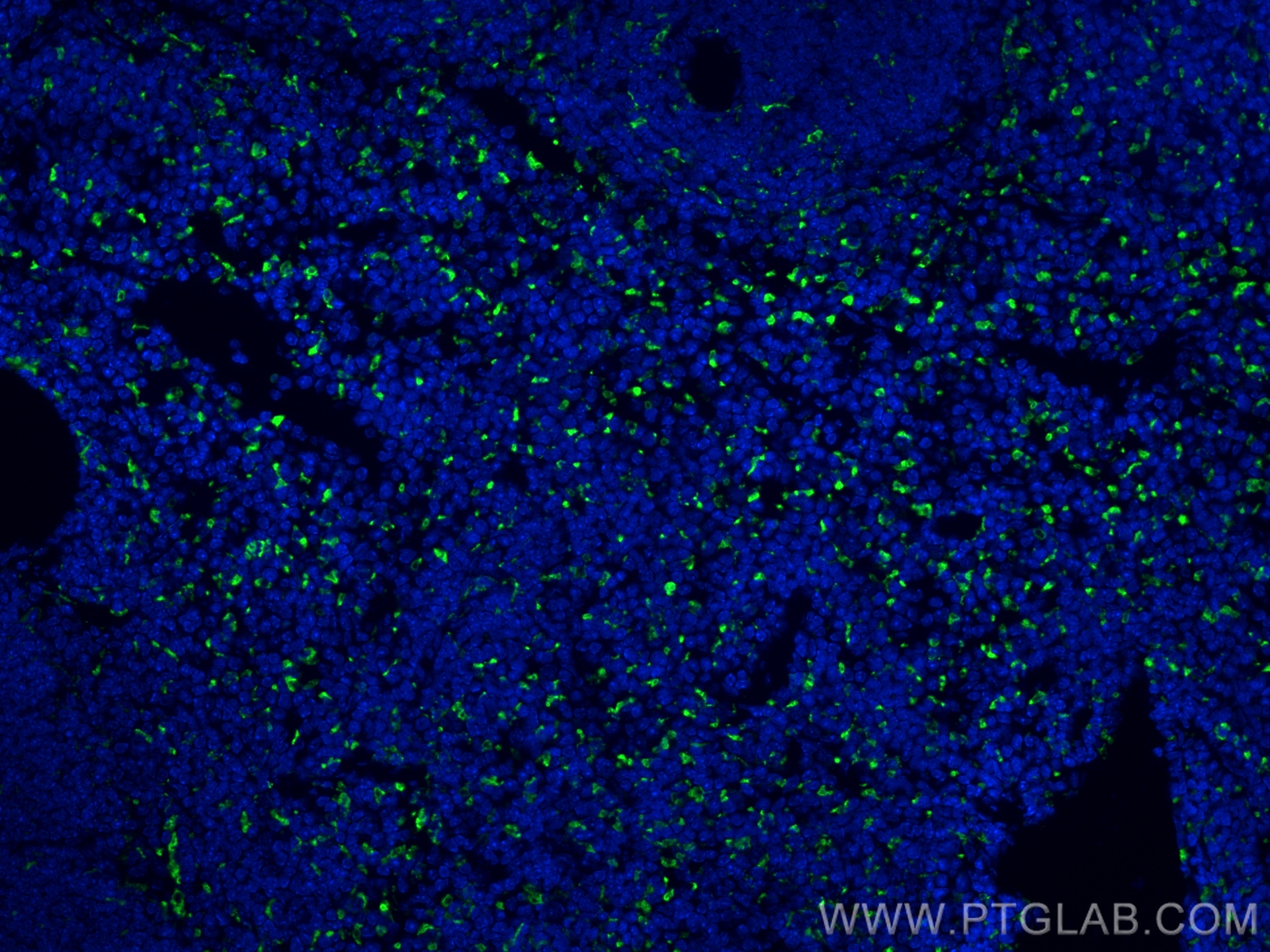 Immunofluorescence (IF) / fluorescent staining of mouse spleen tissue using CD68 Recombinant antibody (83014-5-RR)