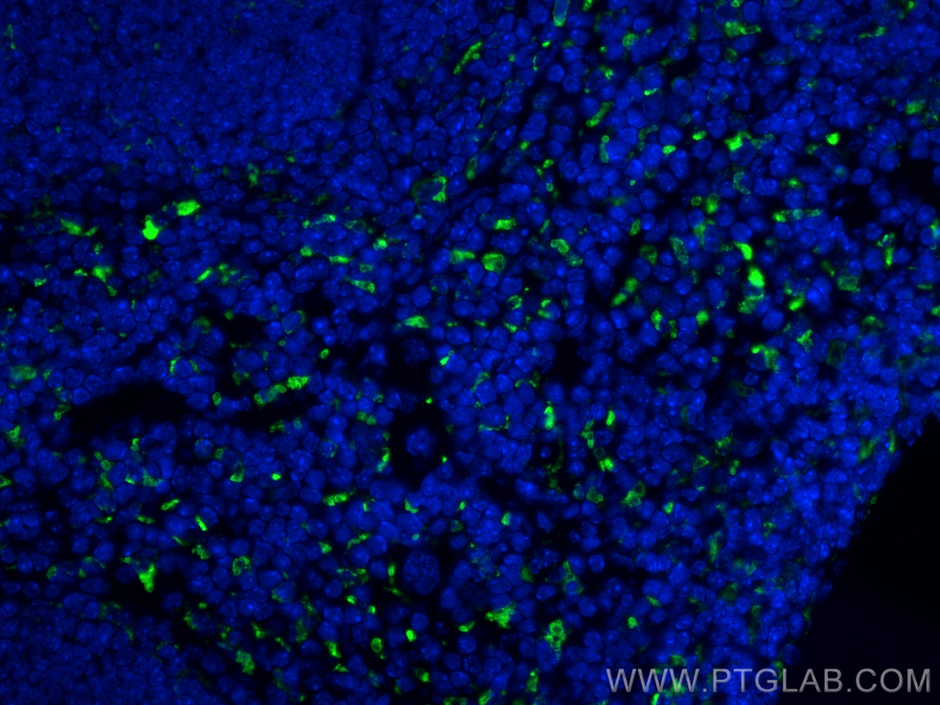 Immunofluorescence (IF) / fluorescent staining of mouse spleen tissue using CD68 Recombinant antibody (83014-5-RR)