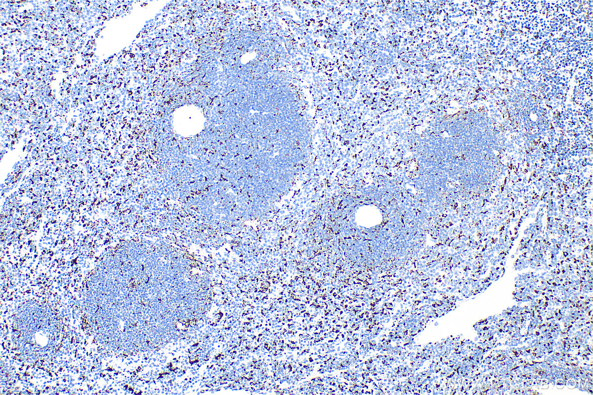 Immunohistochemistry (IHC) staining of mouse spleen tissue using CD68 Recombinant antibody (83014-5-RR)