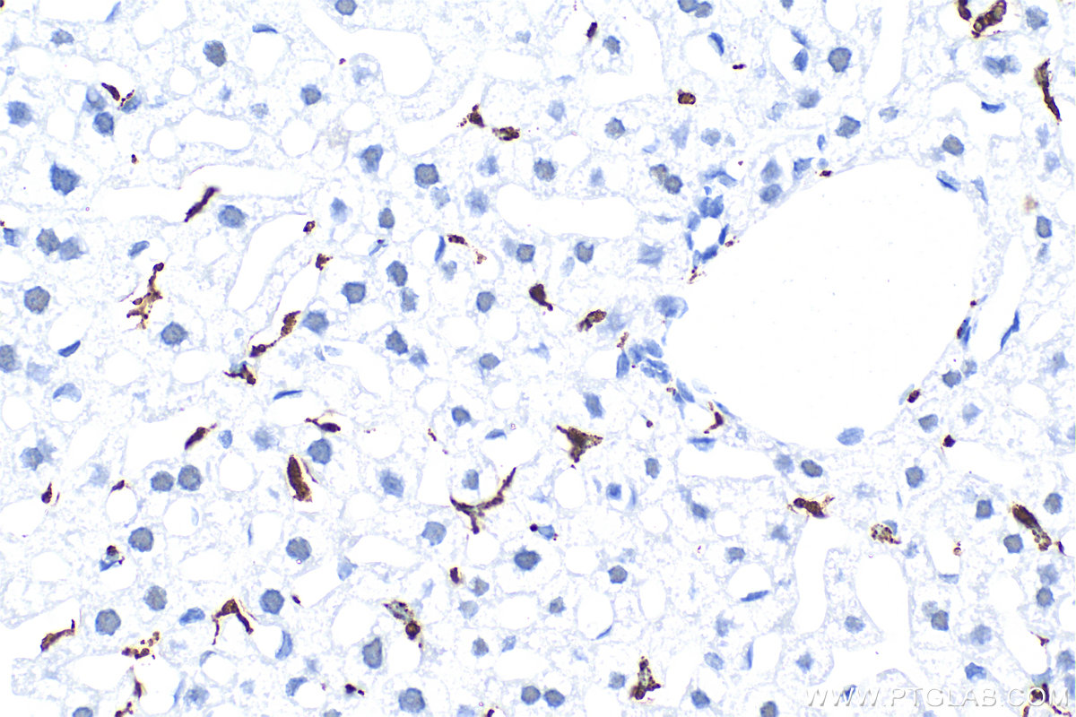 Immunohistochemistry (IHC) staining of mouse liver tissue using CD68 Recombinant antibody (83014-5-RR)