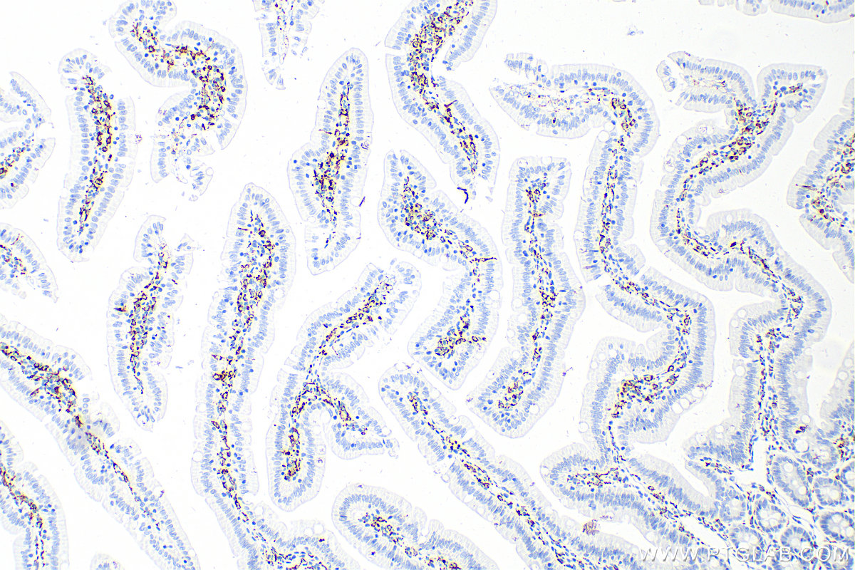 Immunohistochemistry (IHC) staining of rat small intestine tissue using CD68 Recombinant antibody (83014-5-RR)