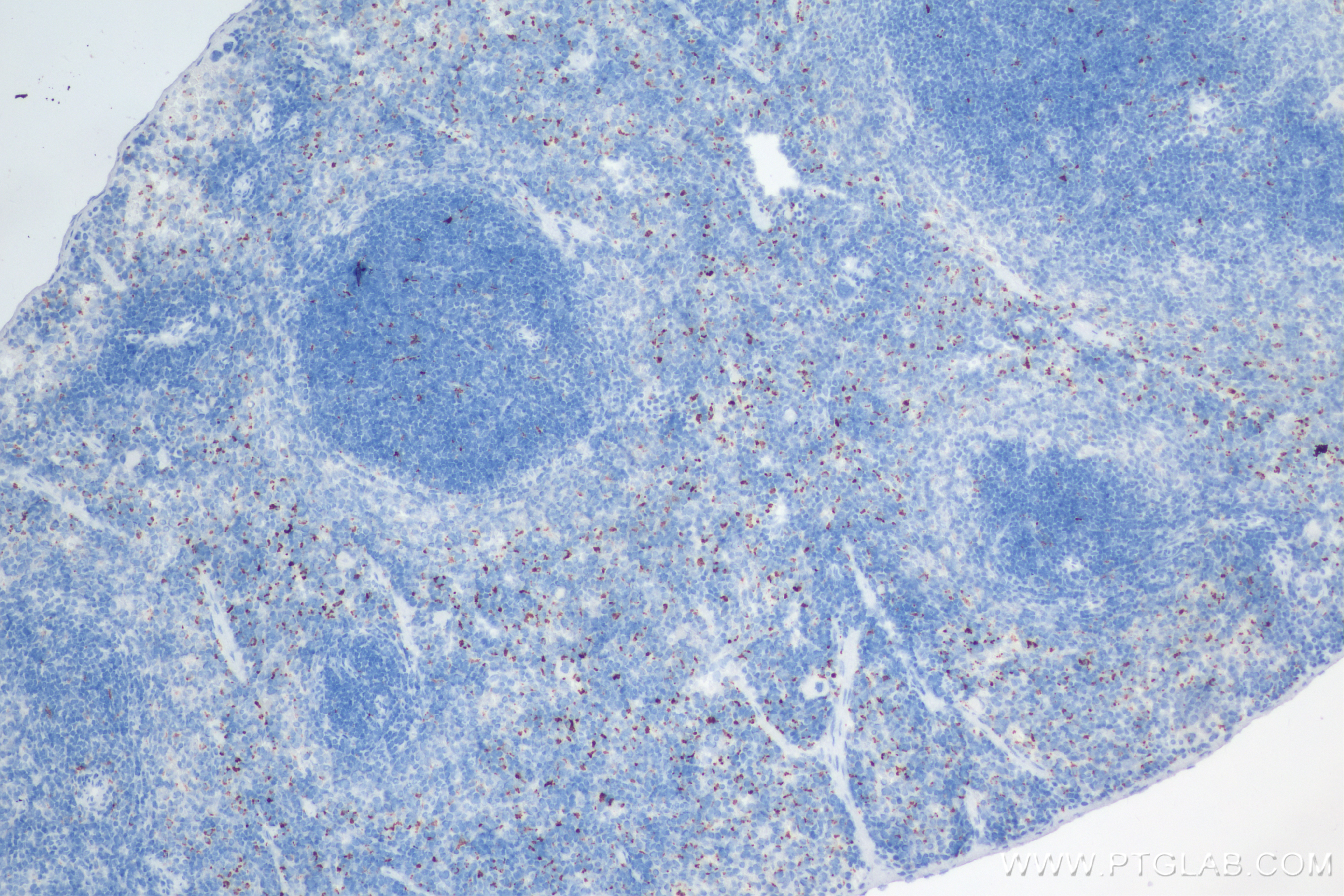 Immunohistochemistry (IHC) staining of mouse spleen tissue using CD68 Recombinant antibody (84596-4-RR)