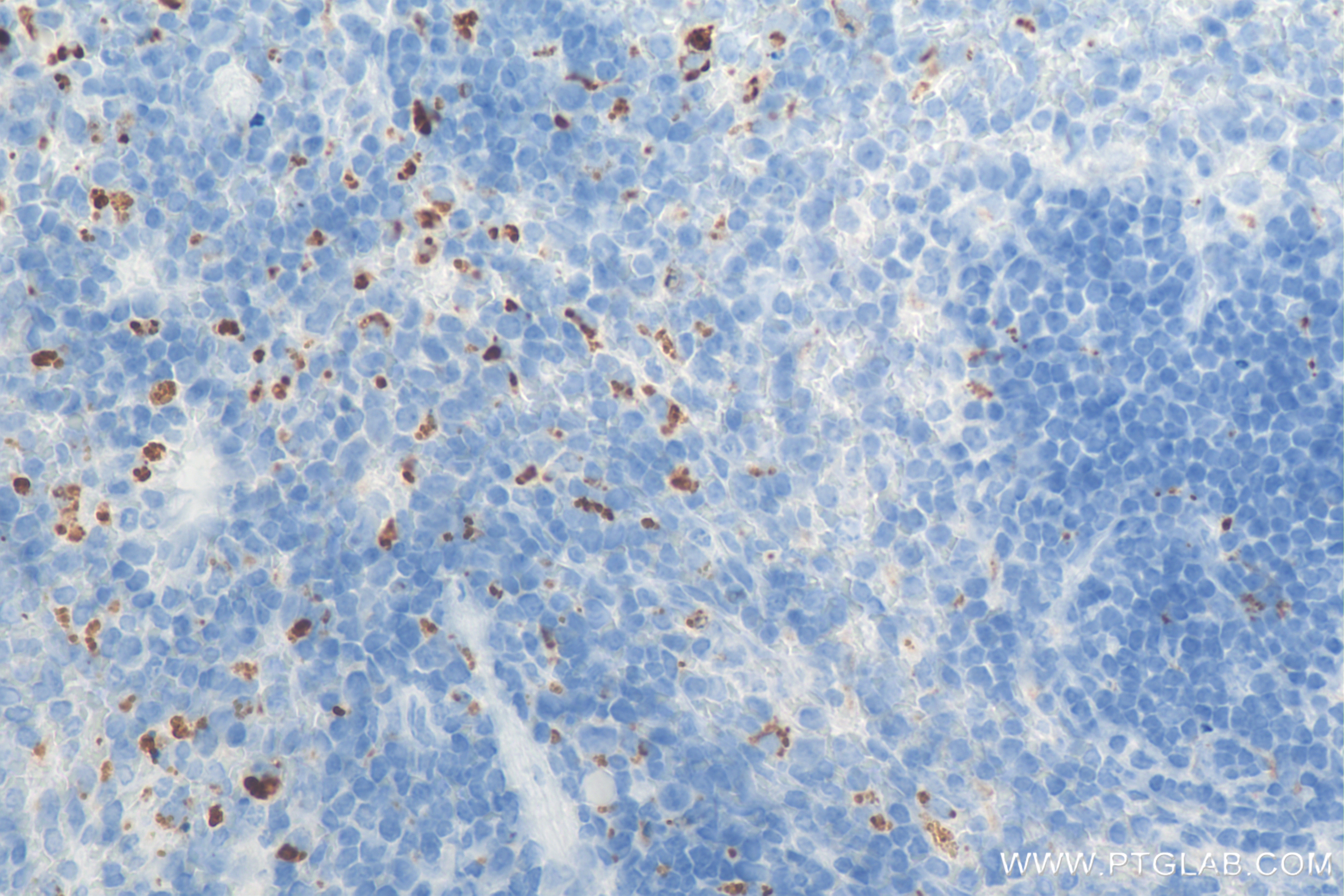 Immunohistochemistry (IHC) staining of mouse spleen tissue using CD68 Recombinant antibody (84596-4-RR)