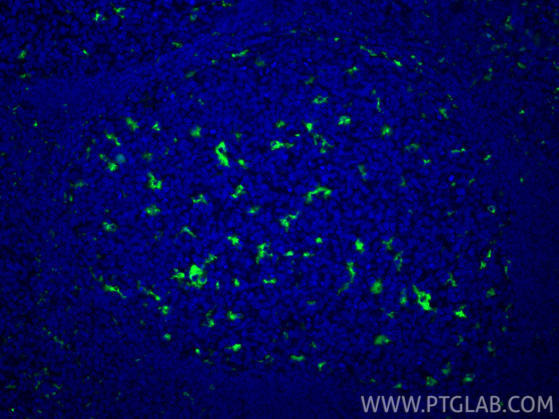 Immunofluorescence (IF) / fluorescent staining of human tonsillitis tissue using CoraLite® Plus 488-conjugated CD68 Polyclonal anti (CL488-25747)