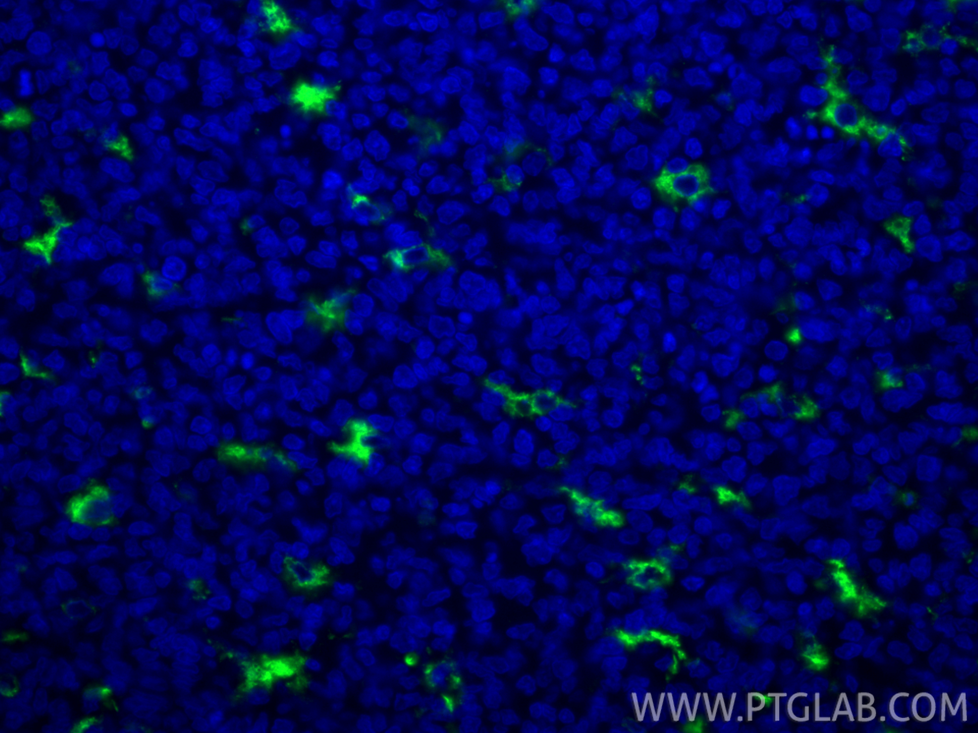 Immunofluorescence (IF) / fluorescent staining of human tonsillitis tissue using CoraLite® Plus 488-conjugated CD68 Polyclonal anti (CL488-25747)
