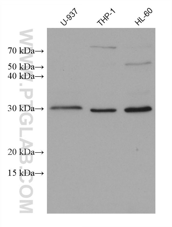 Western Blot (WB) analysis of various lysates using CD69 Monoclonal antibody (68827-1-Ig)