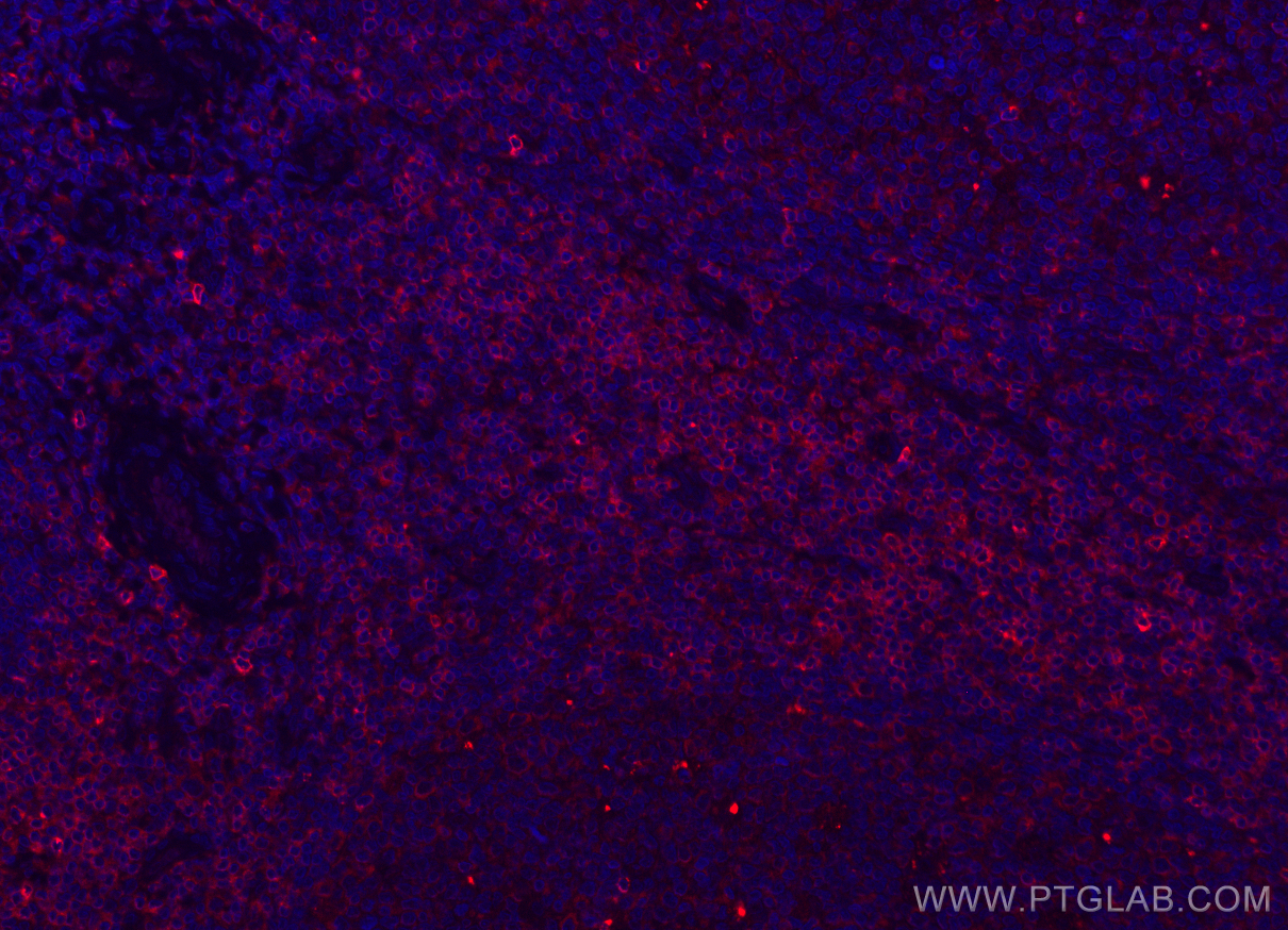 Immunofluorescence (IF) / fluorescent staining of human tonsillitis tissue using CoraLite®594-conjugated CD7 Monoclonal antibody (CL594-60209)