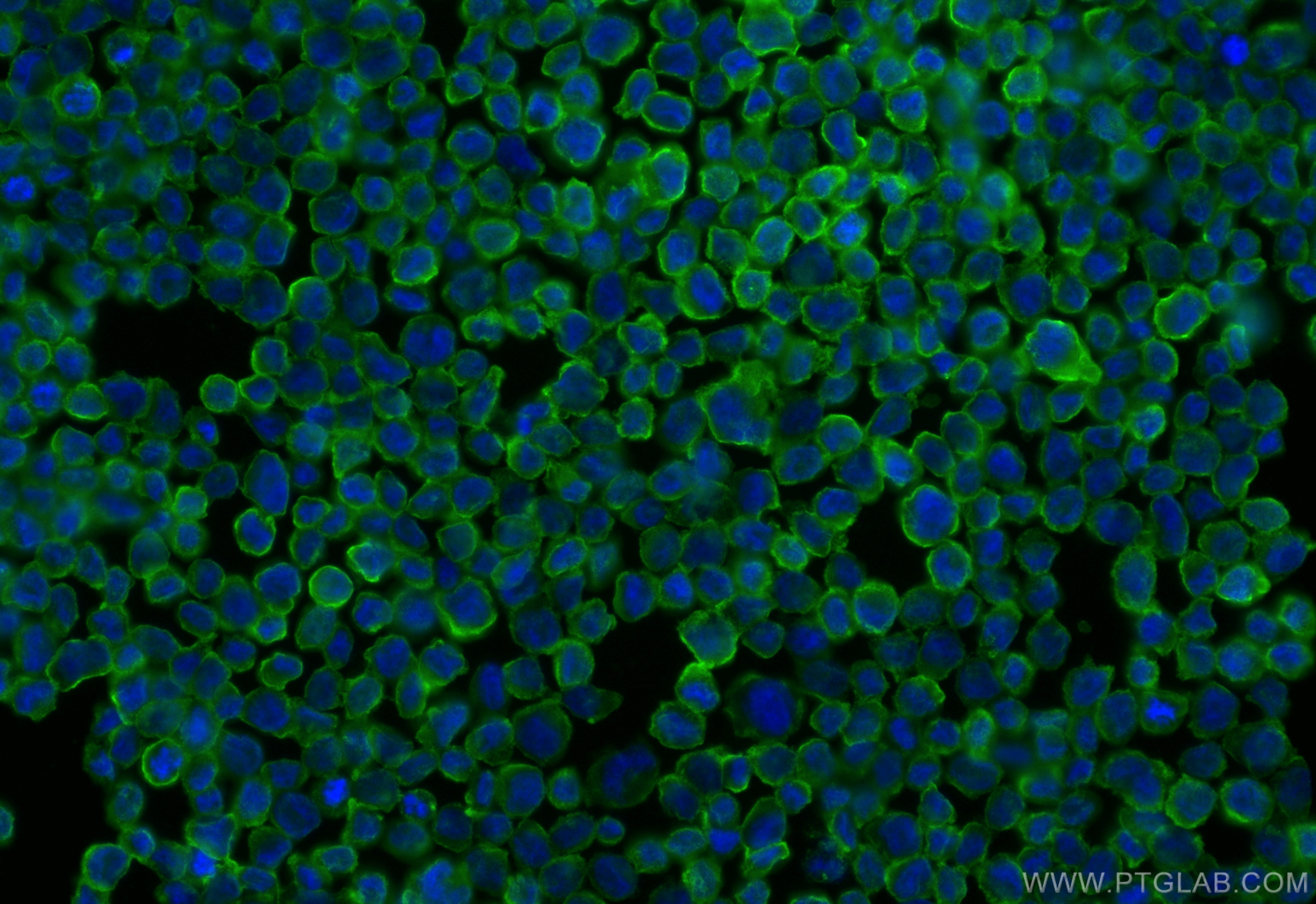 Immunofluorescence (IF) / fluorescent staining of THP-1 cells using CD70 Recombinant antibody (84455-2-RR)