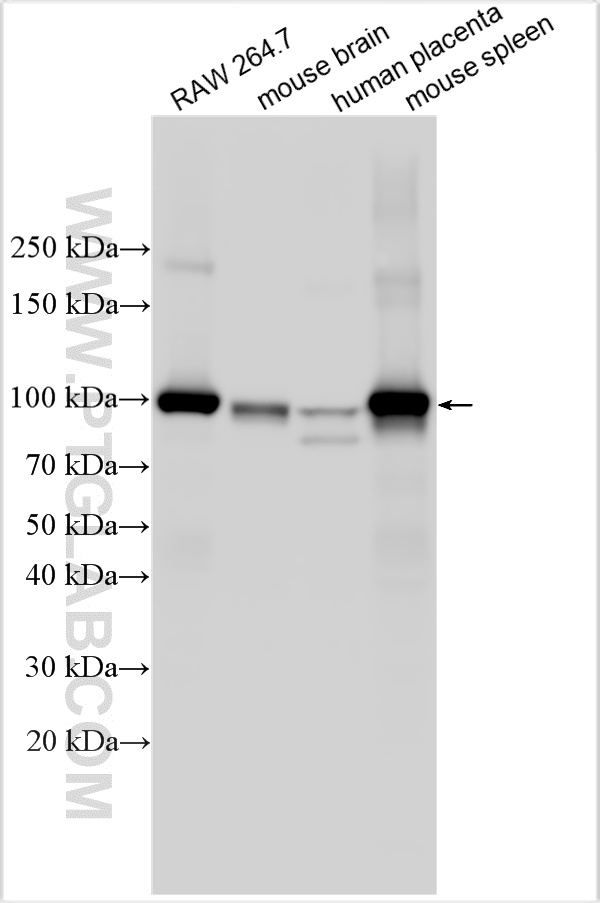 Western Blot (WB) analysis of various lysates using CD71 Polyclonal antibody (32333-1-AP)