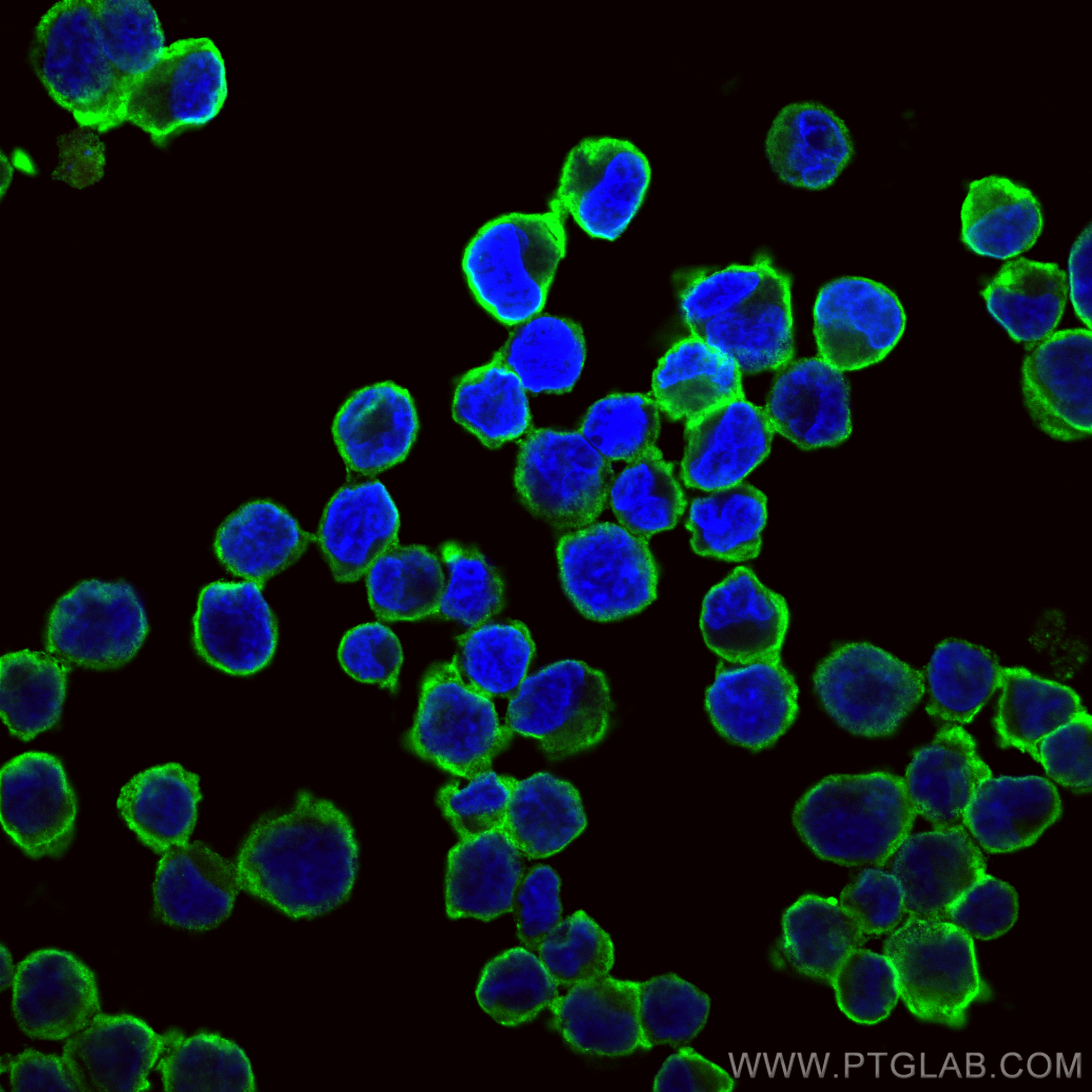 Immunofluorescence (IF) / fluorescent staining of K-562 cells using CD71 Monoclonal antibody (66180-1-Ig)