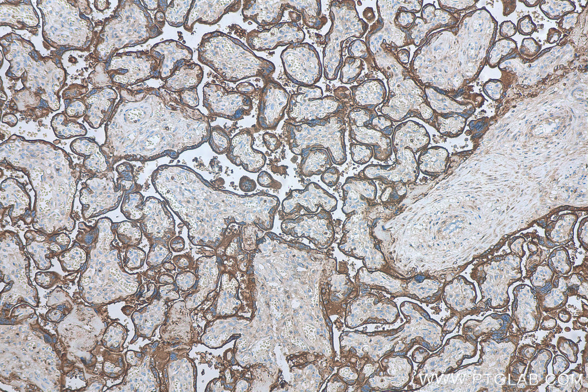 Immunohistochemistry (IHC) staining of human placenta tissue using CD71 Monoclonal antibody (66180-1-Ig)