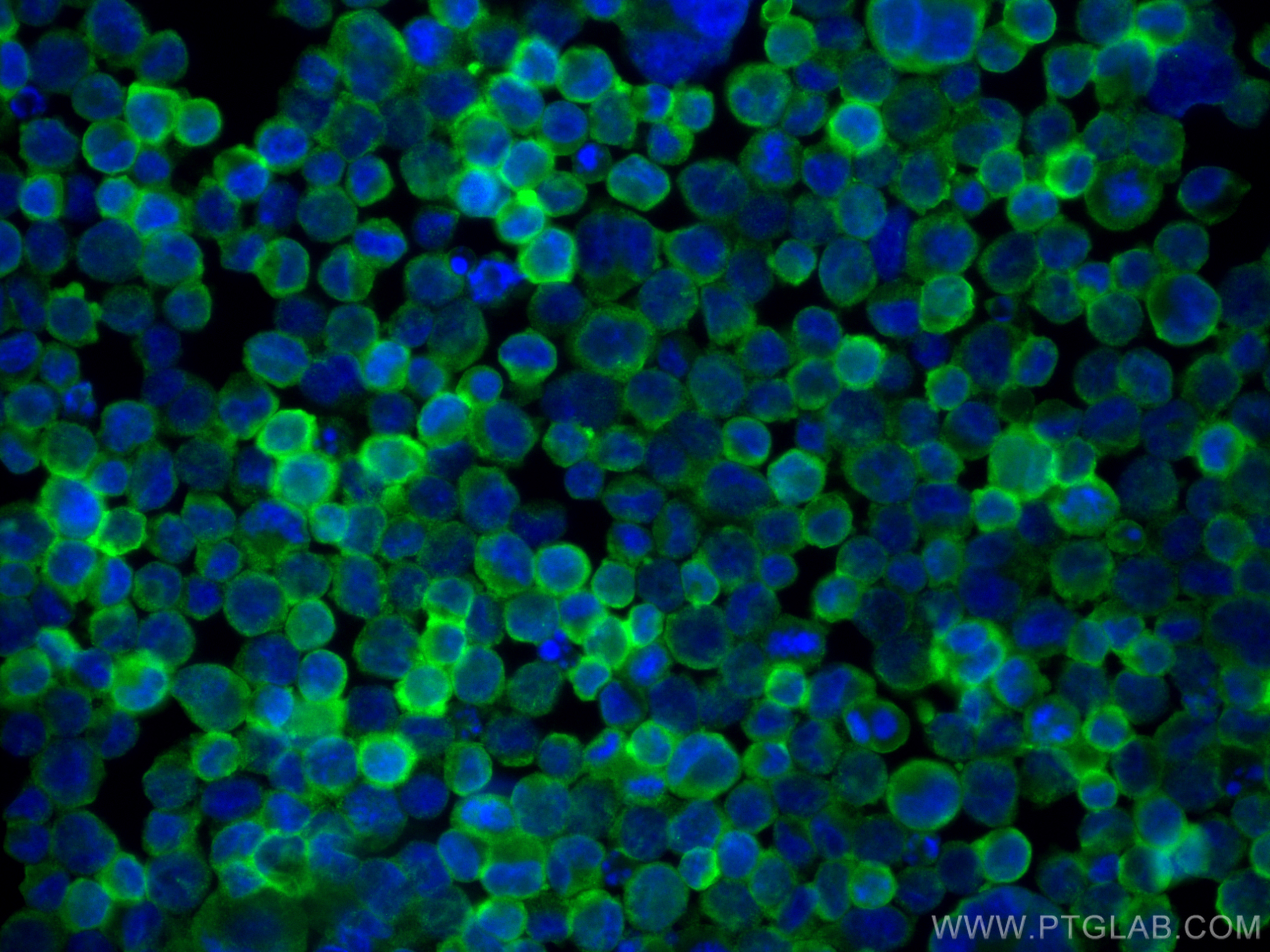 Immunofluorescence (IF) / fluorescent staining of K-562 cells using CD71 Recombinant antibody (81793-2-RR)