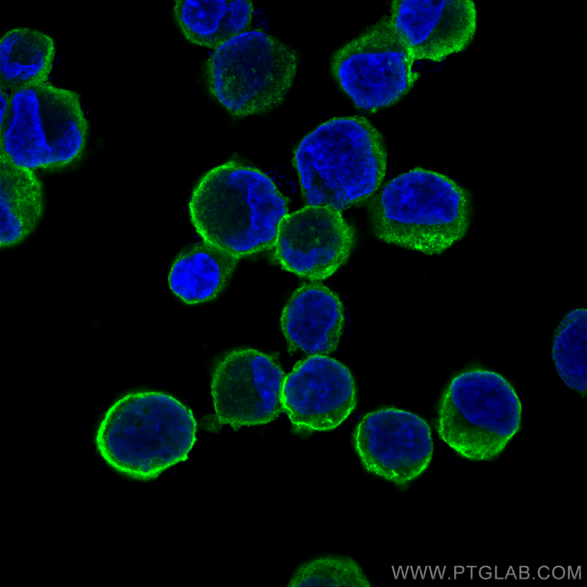 Immunofluorescence (IF) / fluorescent staining of K-562 cells using CD71 Recombinant antibody (81793-2-RR)