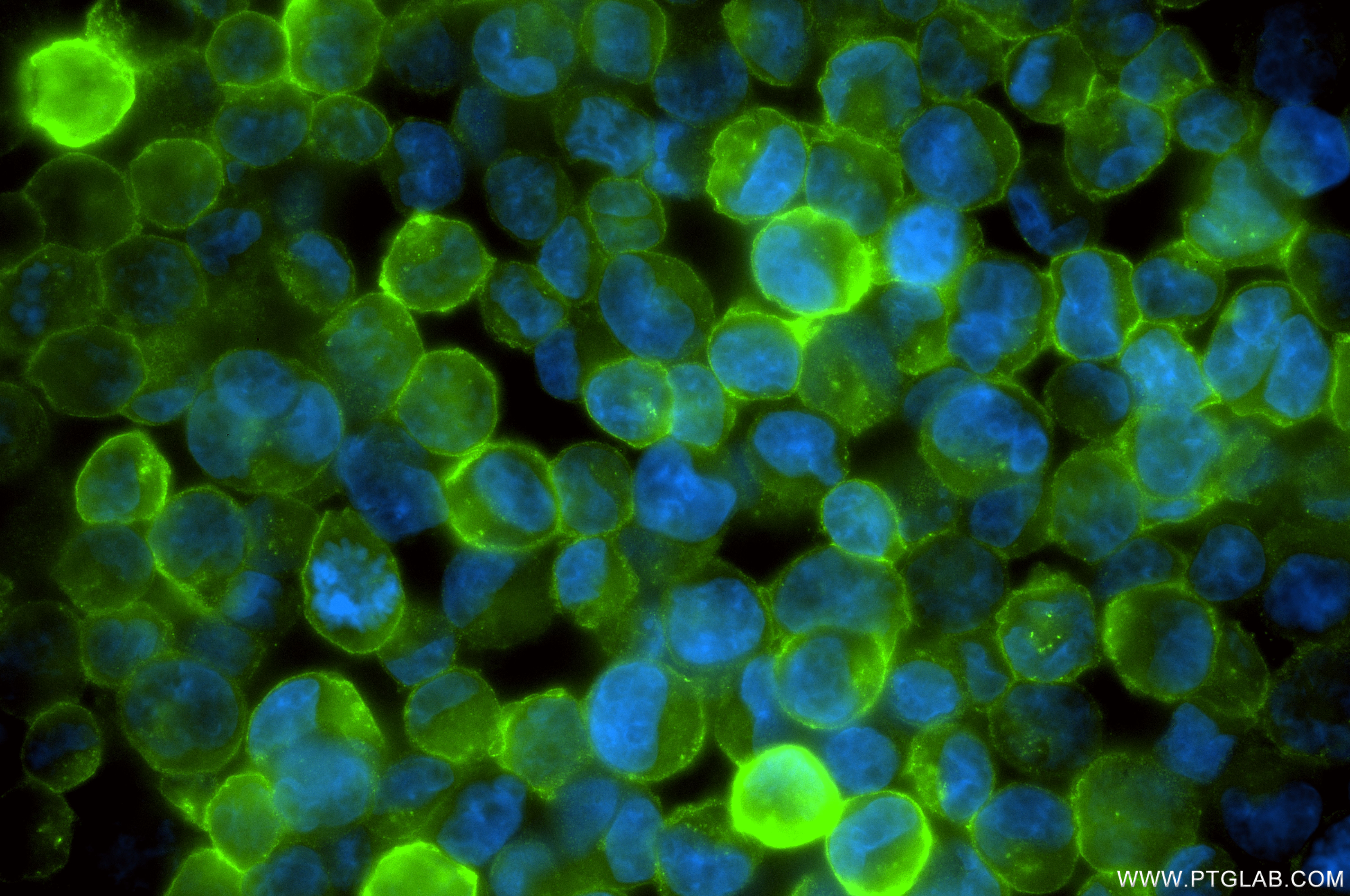 Immunofluorescence (IF) / fluorescent staining of K-562 cells using CD71 Recombinant antibody (81793-3-RR)
