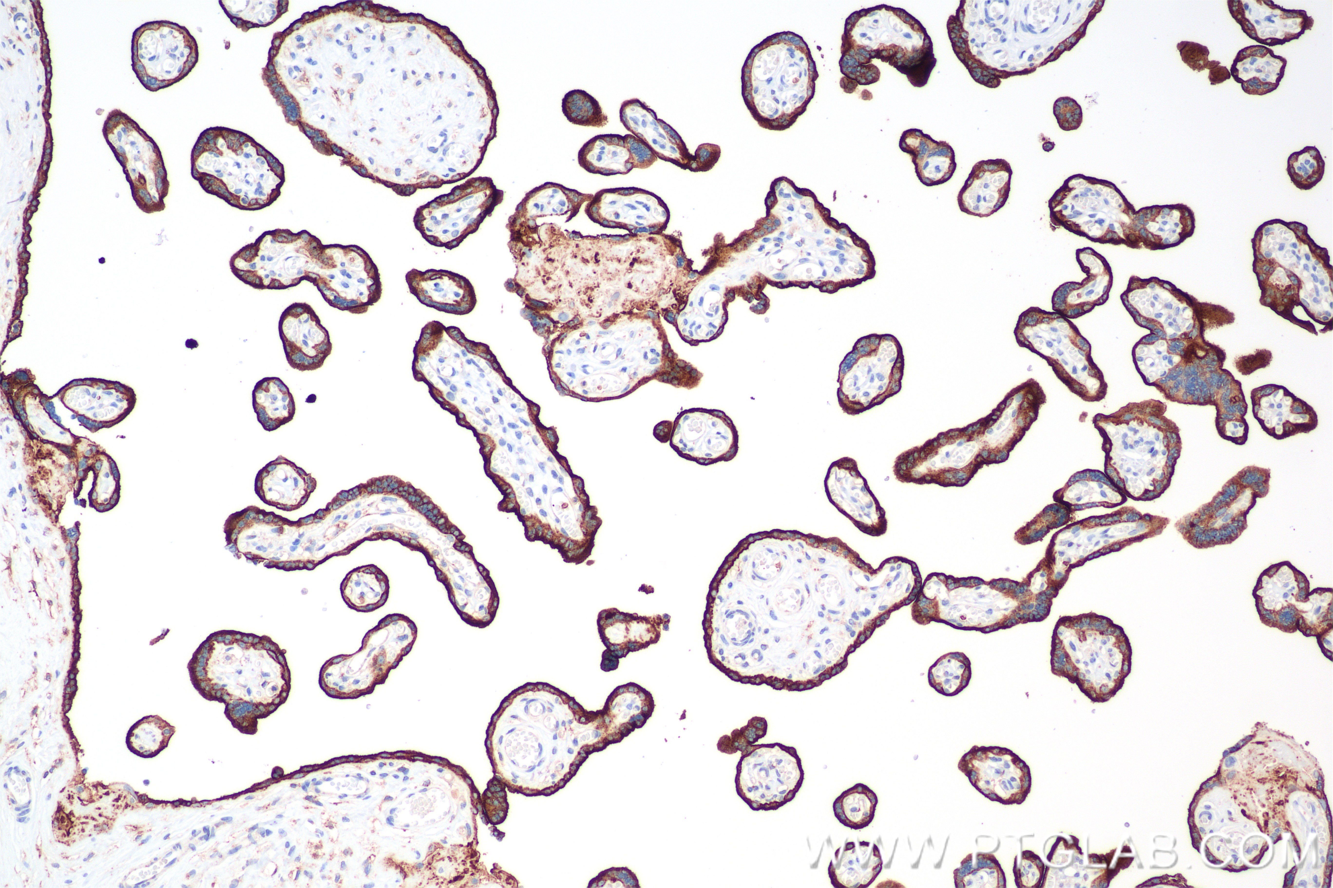 Immunohistochemistry (IHC) staining of human placenta tissue using CD71 Recombinant antibody (81793-3-RR)