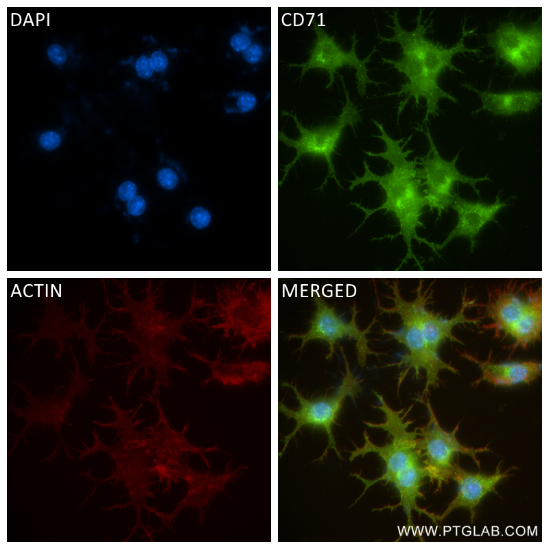 Immunofluorescence (IF) / fluorescent staining of RAW 264.7 cells using CD71 Recombinant antibody (84766-3-RR)