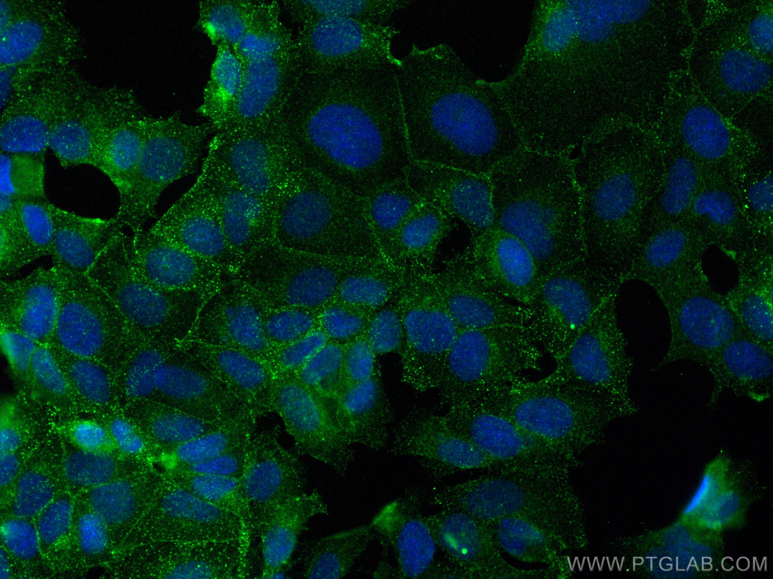 Immunofluorescence (IF) / fluorescent staining of MCF-7 cells using CoraLite® Plus 488-conjugated CD71 Monoclonal anti (CL488-66180)