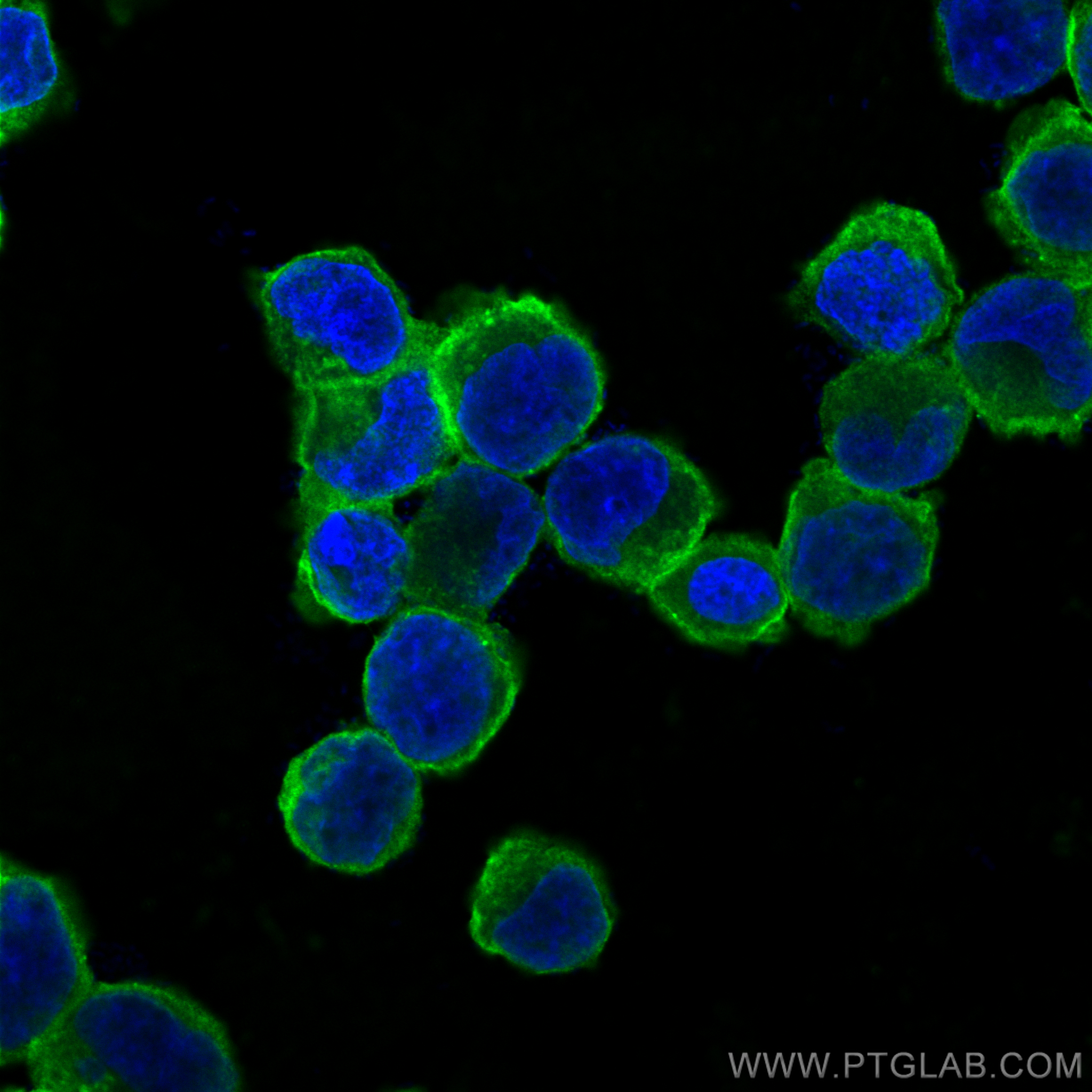 Immunofluorescence (IF) / fluorescent staining of K-562 cells using CoraLite® Plus 488-conjugated CD71 Monoclonal anti (CL488-66180)