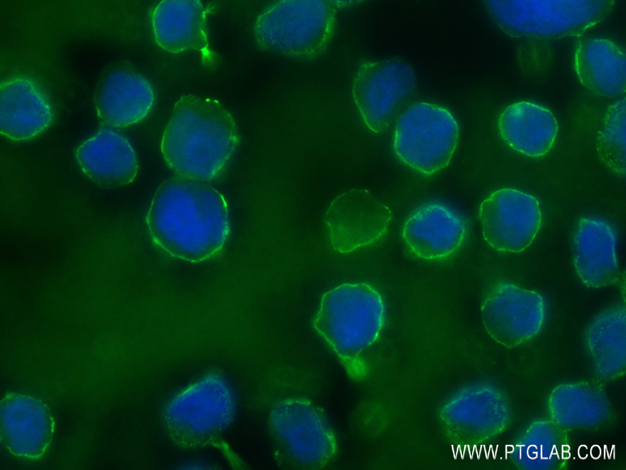 Immunofluorescence (IF) / fluorescent staining of Raji cells using CD79A Recombinant antibody (82747-2-RR)