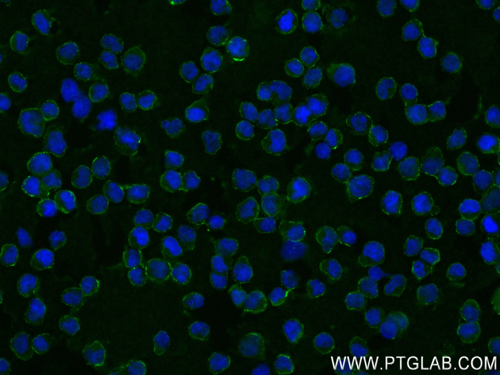 Immunofluorescence (IF) / fluorescent staining of Raji cells using CD79a Recombinant antibody (82747-2-RR)