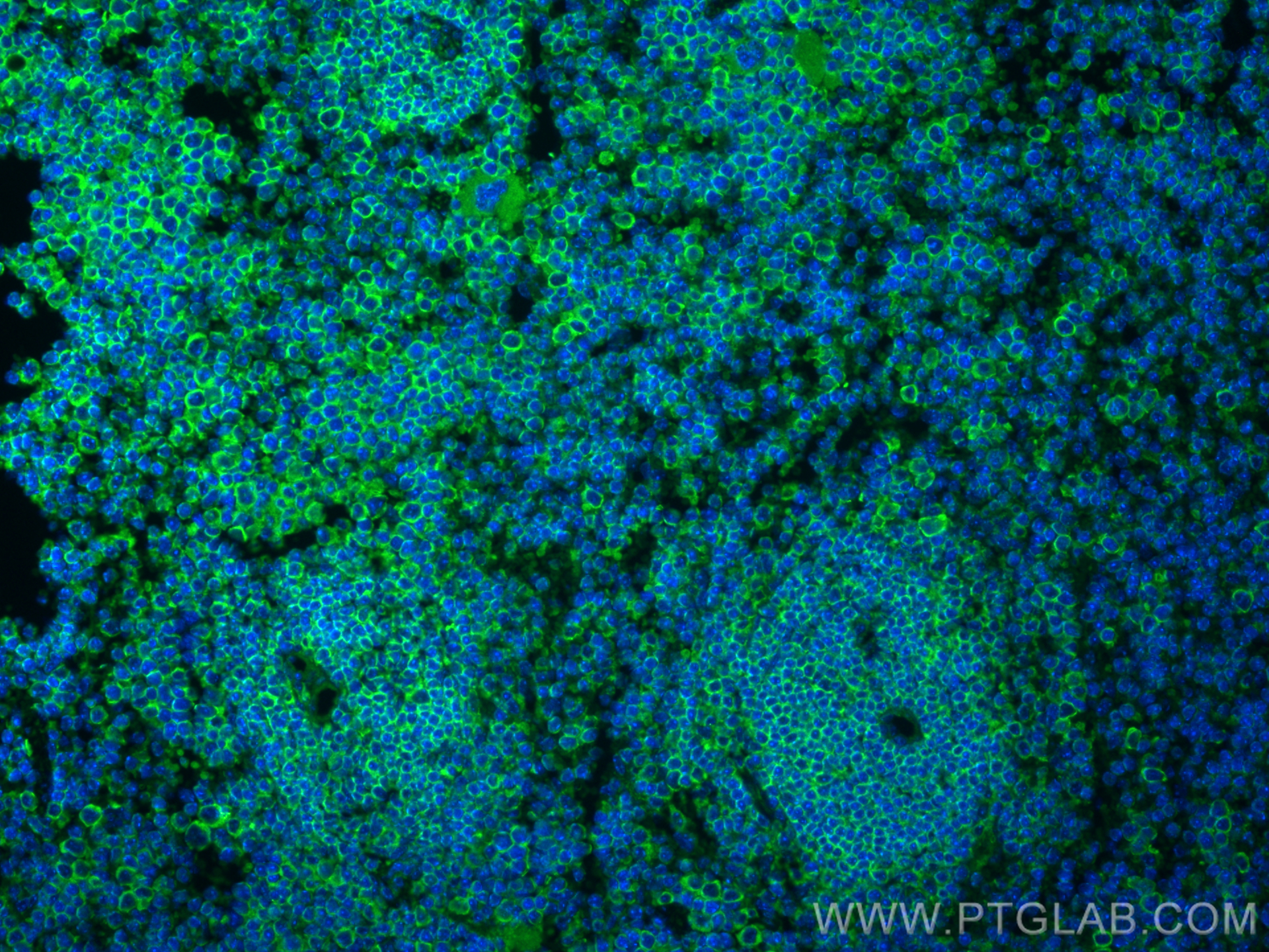 Immunofluorescence (IF) / fluorescent staining of mouse spleen tissue using CD79a Recombinant antibody (82747-2-RR)