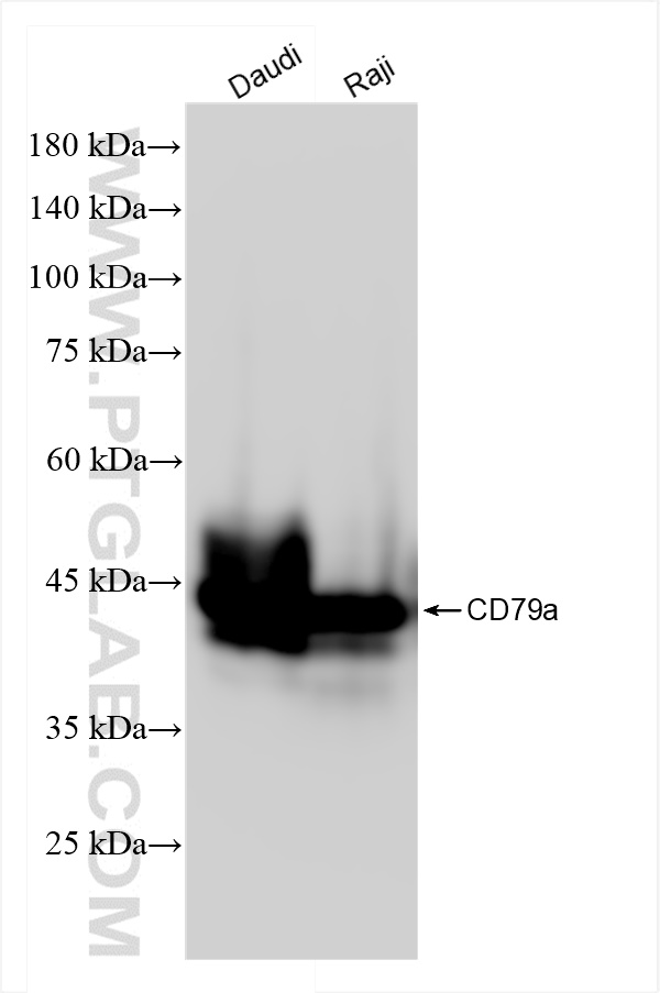 Western Blot (WB) analysis of various lysates using CD79a Recombinant antibody (84236-5-RR)