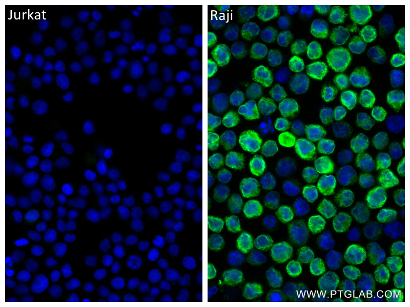 Immunofluorescence (IF) / fluorescent staining of Raji cells using CD79b Recombinant antibody (84234-5-RR)