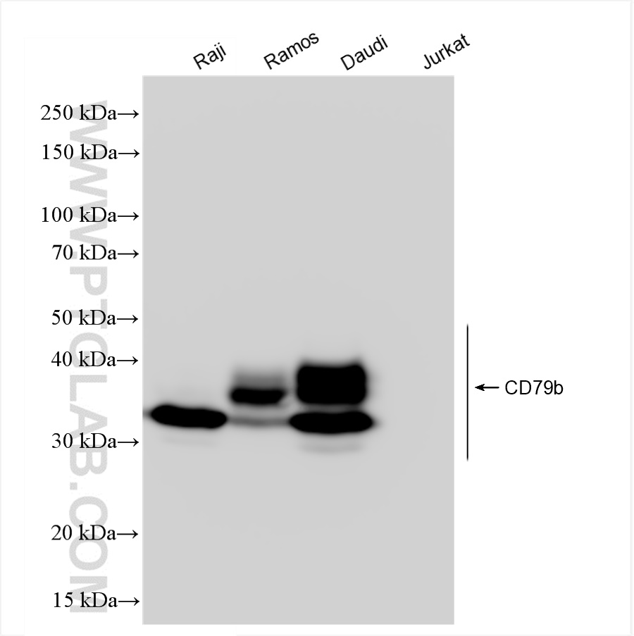 Western Blot (WB) analysis of various lysates using CD79b Recombinant antibody (84234-5-RR)