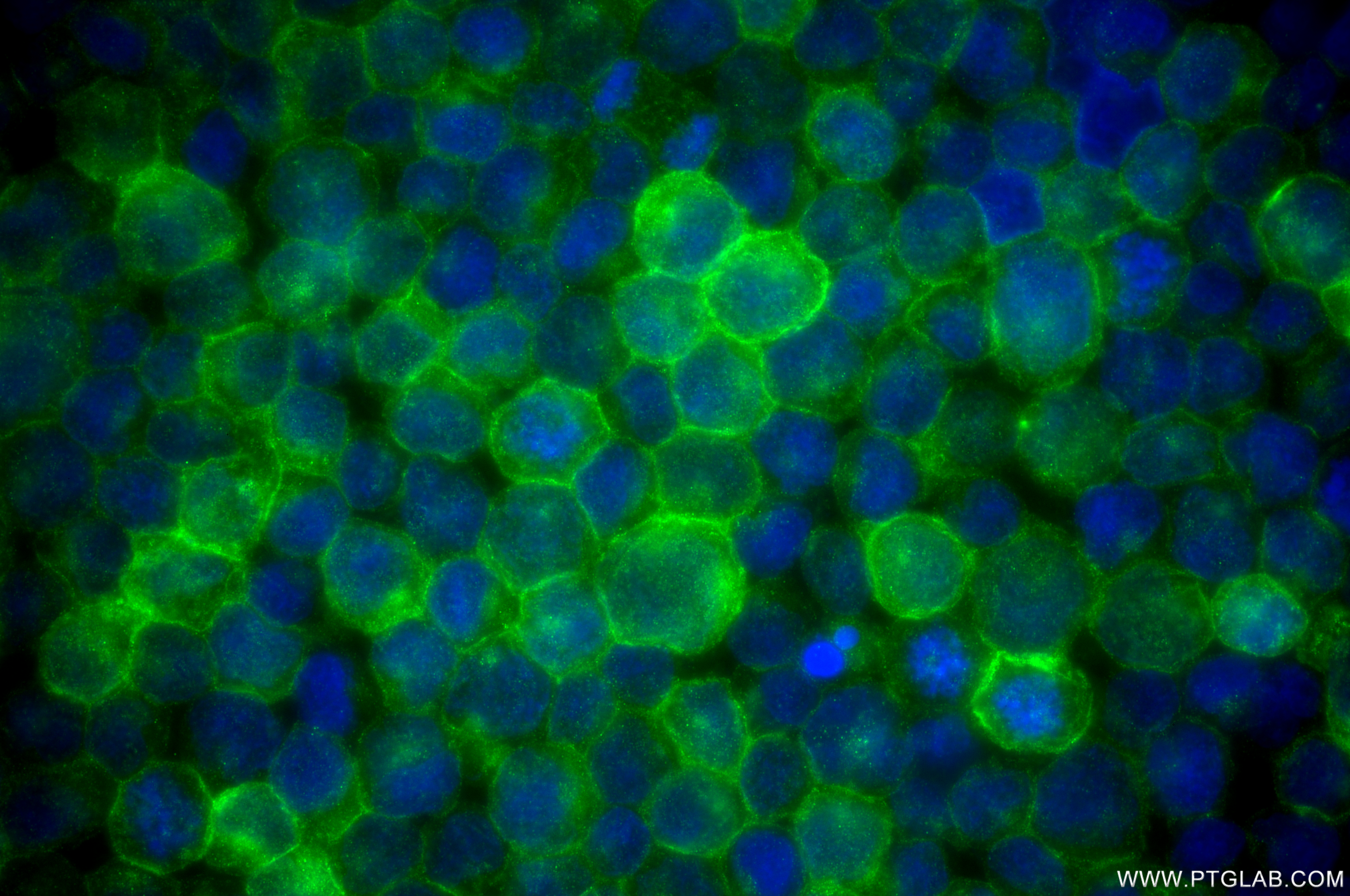 Immunofluorescence (IF) / fluorescent staining of Raji cells using CD80 Recombinant antibody (83198-4-RR)