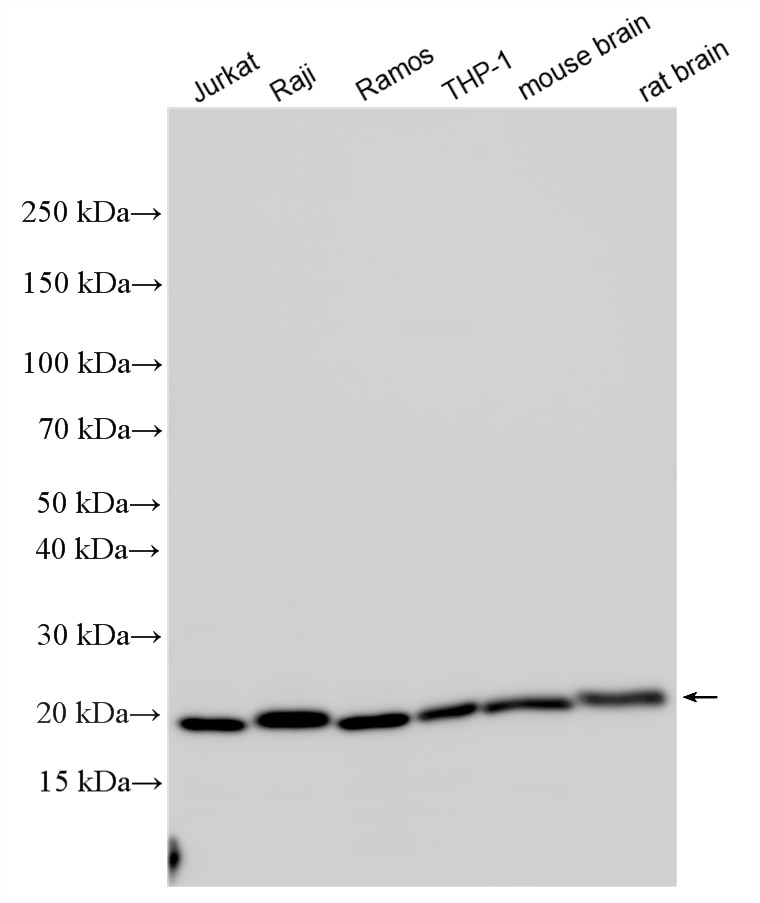 Western Blot (WB) analysis of various lysates using CD81 Polyclonal antibody (27855-1-AP)