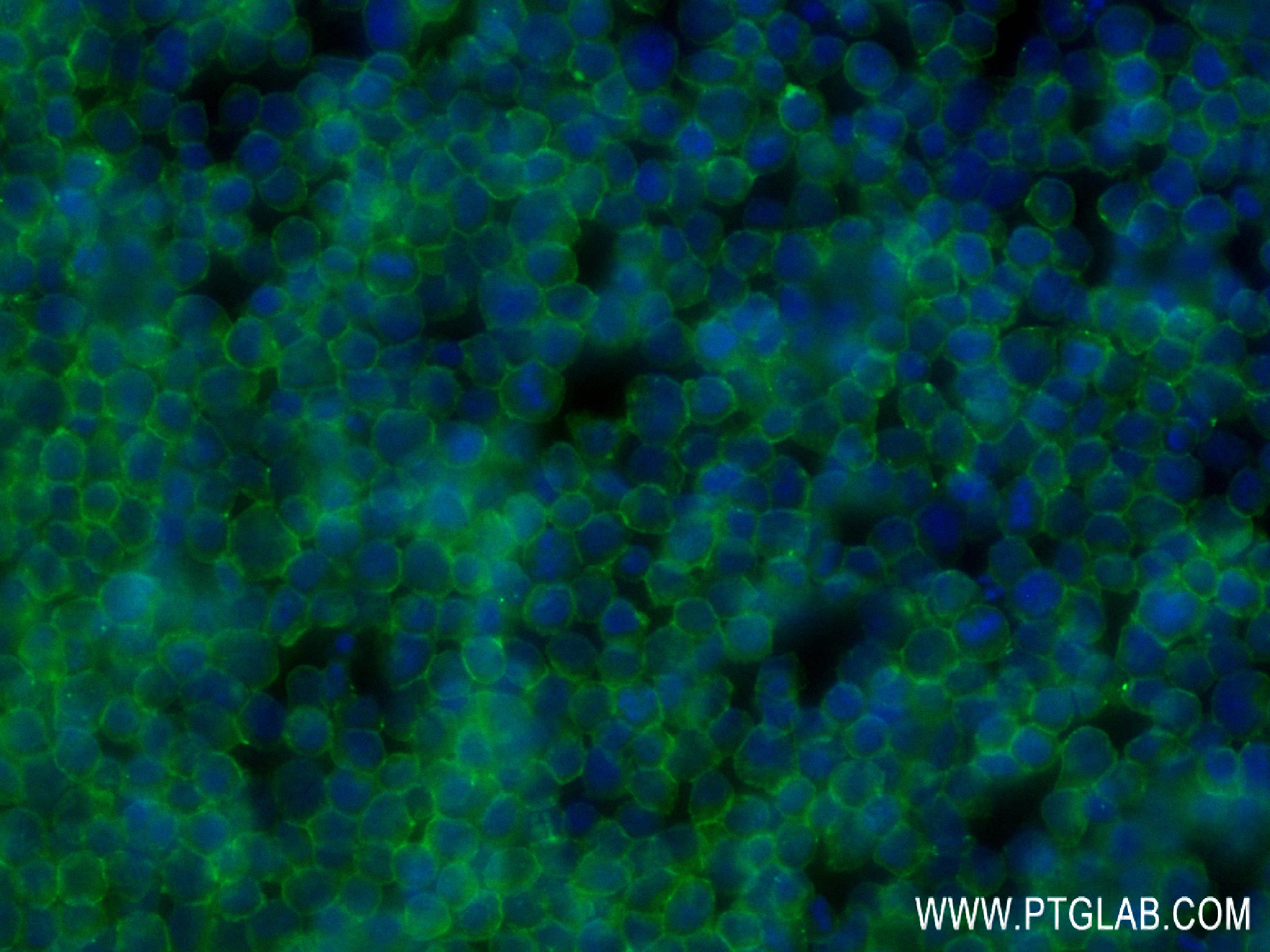 Immunofluorescence (IF) / fluorescent staining of Jurkat cells using CD81 Recombinant antibody (84644-2-RR)