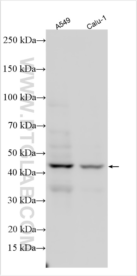 Western Blot (WB) analysis of various lysates using CD82 Polyclonal antibody (10248-1-AP)